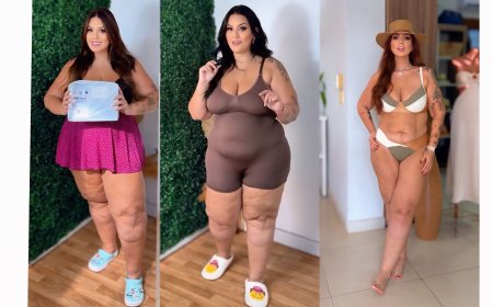 Influencer Mariana Oliveira perde 40 kg após tratamento para lipedema em centro especializado