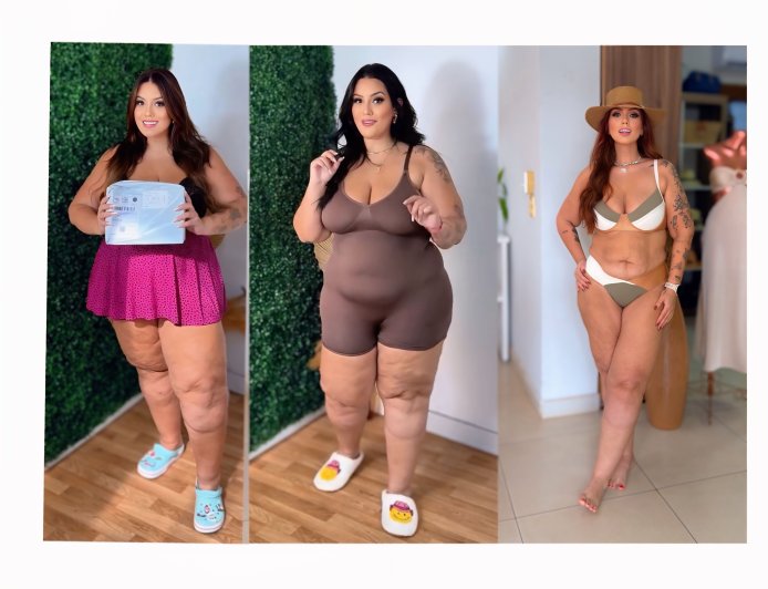 Influencer Mariana Oliveira perde 40 kg após tratamento para lipedema em centro especializado