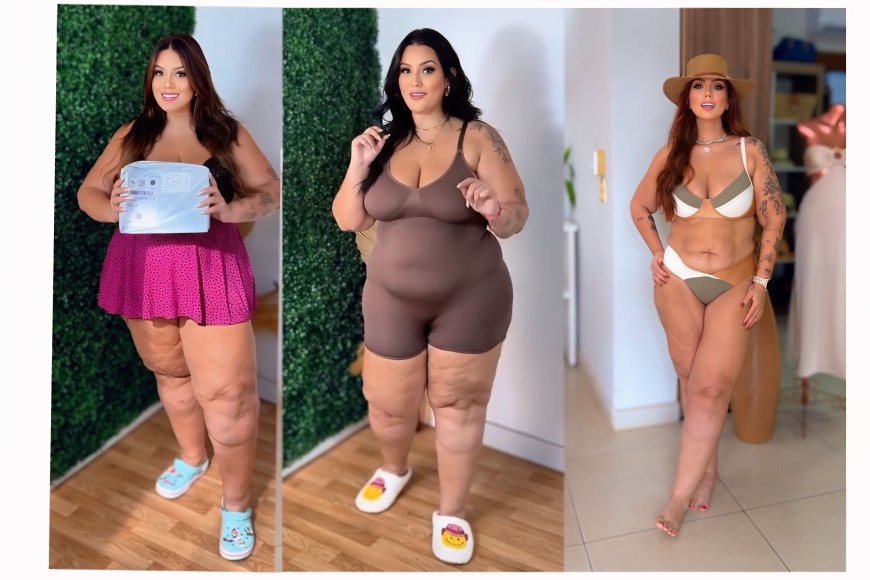 Influencer Mariana Oliveira perde 40 kg após tratamento para lipedema em centro especializado
