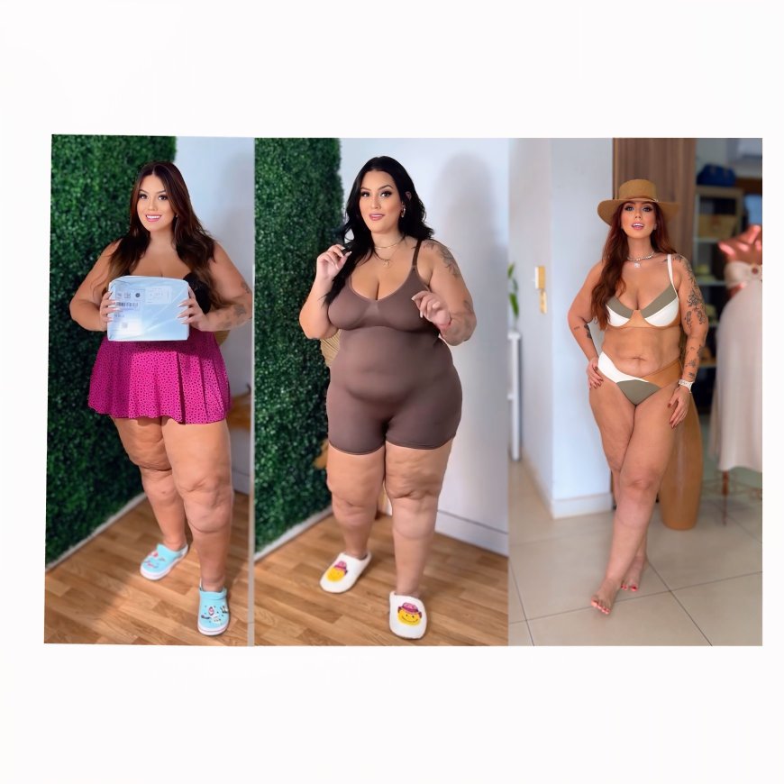 Influencer Mariana Oliveira perde 40 kg após tratamento para lipedema em centro especializado
